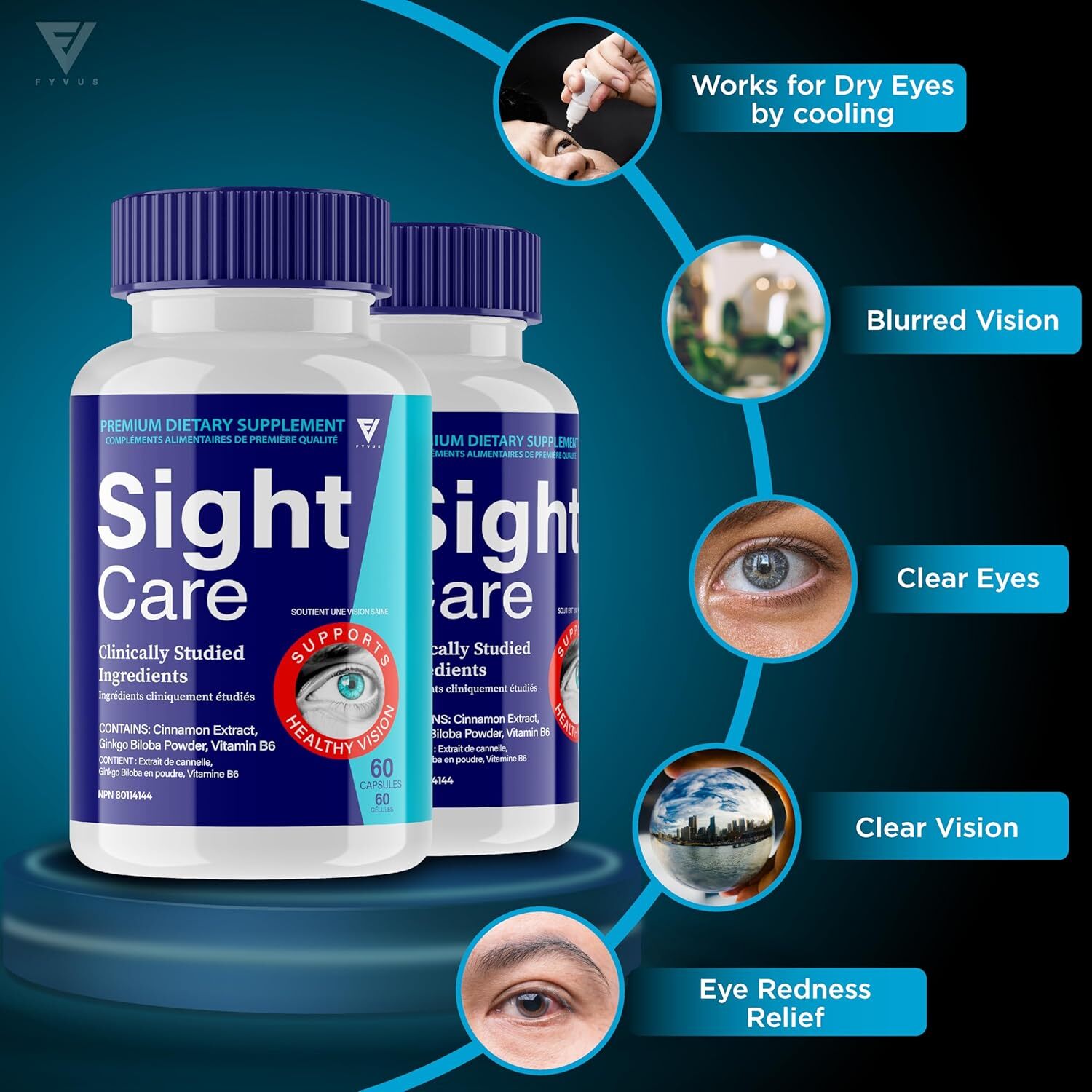 SightCare Working Process