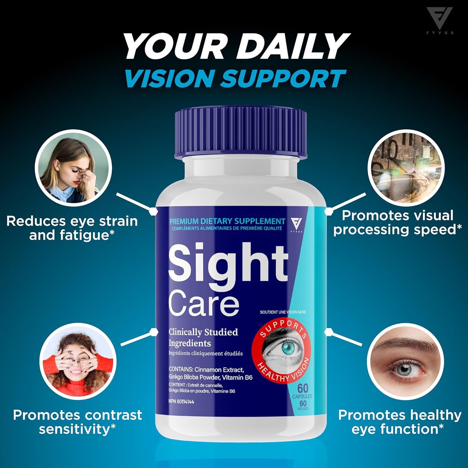 What Is SightCare?